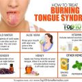 Hanging Tongue Syndrome Treatment – Best Ways To Treat