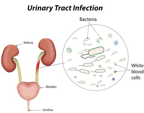 What are signs of Yorkie bladder infections