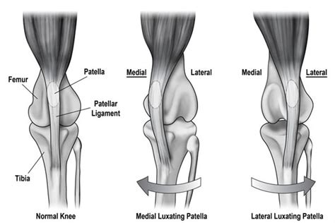 What is Yorkie patellar luxation